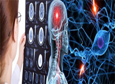 <p>Beyin damar hastalıkları ( inme vb.)<br />
P